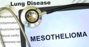 Mesothelioma Suit: Seeking Justice for Asbestos-Related Illnesses